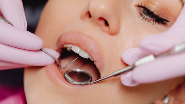 Understanding the Denture Fitting Process